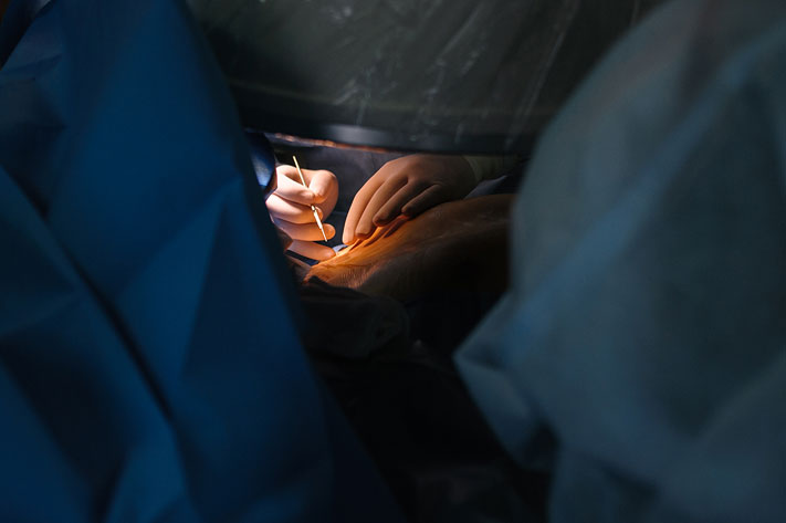 Медицина и здоровье, Томские новости, пластическая хирургия младенец операция удаление опухоли у младенцев В Томске прооперировали новорожденную с опухолью над бровью